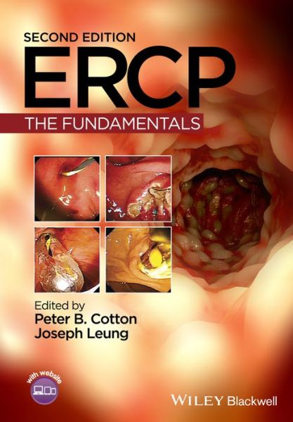 Cover for Peter B Cotton · Ercp (Book) [2nd edition] (2015)