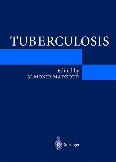 Cover for Tuberculosis (Paperback Book) [Softcover reprint of the original 1st ed. 2004 edition] (2003)
