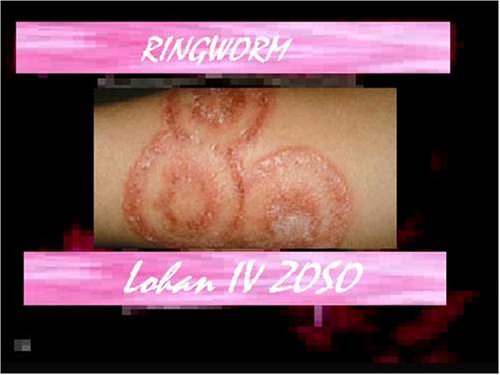 Cover for Ringworm · Lindsay Lohan Iv Zoso (CD) (2005)
