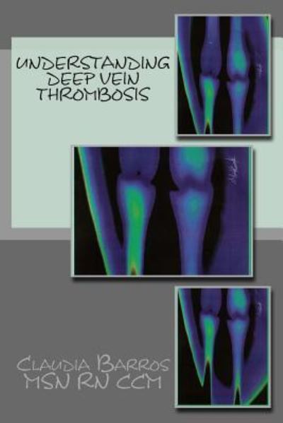 Cover for Claudia Barros · Understanding Deep Vein Thrombosis (Paperback Book) (2017)