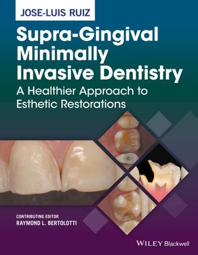 Cover for Ruiz, Jose-Luis (Private Practice, Los Angeles, California, USA) · Supra-Gingival Minimally Invasive Dentistry: A Healthier Approach to Esthetic Restorations (Inbunden Bok) (2017)