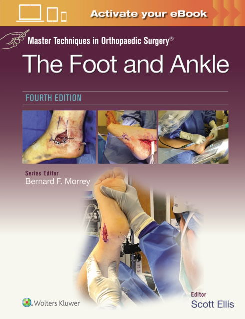 Cover for Scott Ellis · Master Techniques in Orthopaedic Surgery: The Foot and Ankle: Print + eBook with Multimedia - Master Techniques in Orthopaedic Surgery (Hardcover Book) (2024)