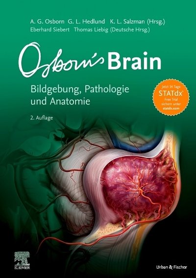Cover for Osborn · Osborn's Brain (Buch)