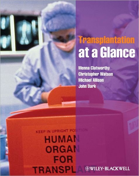 Cover for Clatworthy, Menna (University of Cambridge, Addenbrooke's Hospital, Cambridge, UK) · Transplantation at a Glance - At a Glance (Pocketbok) (2012)