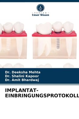 Cover for Dr Deeksha Mehta · Implantat-Einbringungsprotokoll (Paperback Book) (2021)