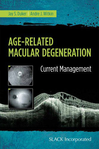 Cover for Jay Duker · Age-Related Macular Degeneration: Current Management (Taschenbuch) (2014)