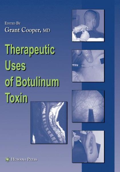Cover for Grant C Cooper · Therapeutic Uses of Botulinum Toxin - Musculoskeletal Medicine (Paperback Book) (2011)