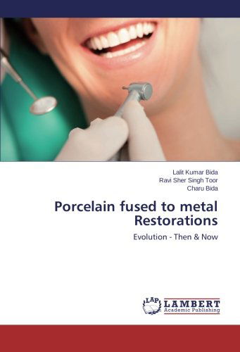 Cover for Charu Bida · Porcelain Fused to Metal Restorations: Evolution - then &amp; Now (Paperback Book) (2014)