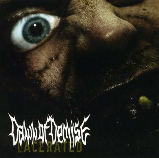 Cover for Dawn of Demise · Lacerated (SCD) (2010)