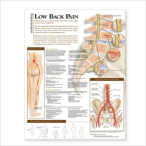 Cover for Anatomical Chart Company · Understanding Low Back Pain Anatomical Chart (Landkarten) (2008)