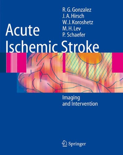 Cover for González · Acute Ischemic Stroke (Book) [1st Edition. Softcover Version of Original Hardcover Edition 200 edition] (2010)