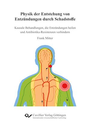 Cover for Frank Mitter · Physik der Entstehung von Entzündungen durch Schadstoffe in der Nahrung, in den Zahnfleischtaschen und von schädlichen Bakterien am Beispiel der rheumatoiden Arthritis. Kausale Behandlungen, die Entzündungen heilen und Antibiotika-Resistenzen verhindern (Paperback Book) (2021)