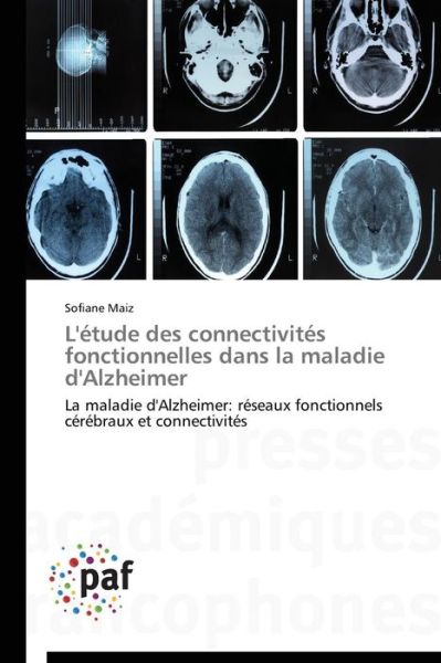 Cover for Sofiane Maiz · L'étude Des Connectivités Fonctionnelles Dans La Maladie D'alzheimer: La Maladie D'alzheimer: Réseaux Fonctionnels Cérébraux et Connectivités (Paperback Book) [French edition] (2018)