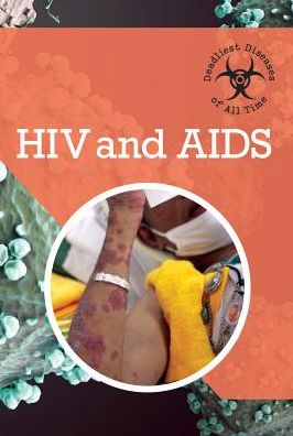 Cover for Holly Cefrey · Hiv and Aids (Hardcover Book) (2015)