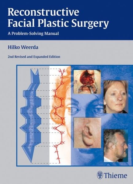 Cover for Hilko Weerda · Reconstructive Facial Plastic Surgery: A Problem-Solving Manual (Hardcover Book) [2nd Revised and Expanded edition] (2014)
