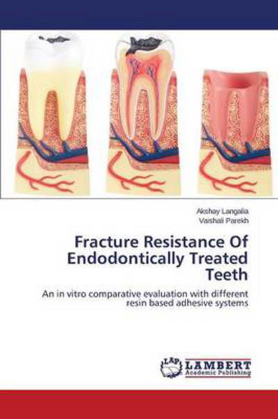 Cover for Vaishali Parekh · Fracture Resistance of Endodontically Treated Teeth: an in Vitro Comparative Evaluation with Different Resin Based Adhesive Systems (Pocketbok) (2014)