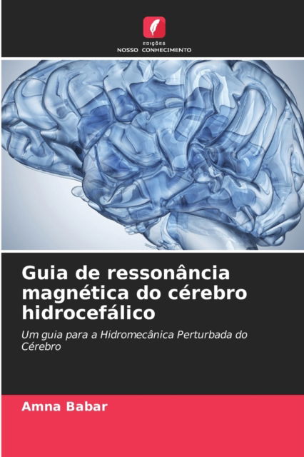 Cover for Amna Babar · Guia de ressonancia magnetica do cerebro hidrocefalico (Pocketbok) (2021)