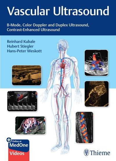 Cover for R Kubale · Vascular Ultrasound: B-Mode, Color Doppler and Duplex Ultrasound, Contrast-Enhanced Ultrasound (Paperback Book) (2024)