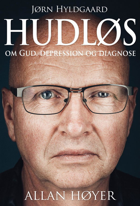 Cover for Allan Høyer · Hudløs (Hardcover Book) (2015)