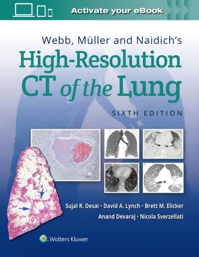 Cover for Sujal Desai · Webb, Muller and Naidich's High-Resolution CT of the Lung (Hardcover bog) (2021)