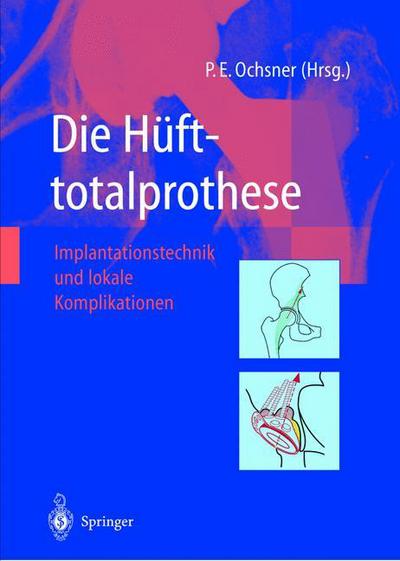 Cover for Ochsner  Peter E. · Die Hufttotalprothese: Implantationstechnik und lokale Komplikationen (Paperback Book) (2012)