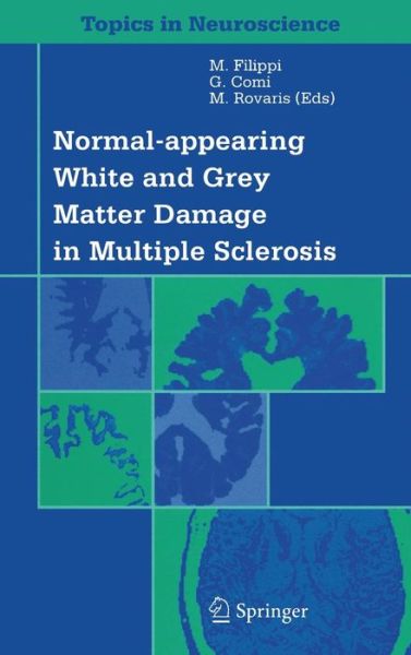 Cover for M Filippi · Normal-appearing White and Grey Matter Damage in Multiple Sclerosis - Topics in Neuroscience (Hardcover Book) [2004 edition] (2004)