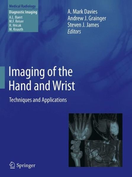Imaging of the Hand and Wrist: Techniques and Applications - Diagnostic Imaging - A Mark Davies - Bücher - Springer-Verlag Berlin and Heidelberg Gm - 9783642111433 - 27. April 2013