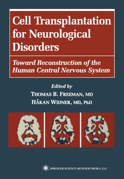Cover for Thomas B Freeman · Cell Transplantation for Neurological Disorders: Toward Reconstruction of the Human Central Nervous System - Contemporary Neuroscience (Paperback Book) [1st Ed. Softcover of Orig. Ed. 1998 edition] (2011)