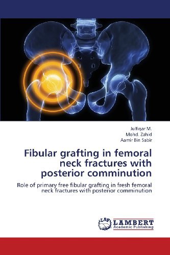 Cover for Aamir Bin Sabir · Fibular Grafting in Femoral Neck Fractures with Posterior Comminution: Role of Primary Free Fibular Grafting in Fresh Femoral Neck Fractures with Posterior Comminution (Pocketbok) (2013)
