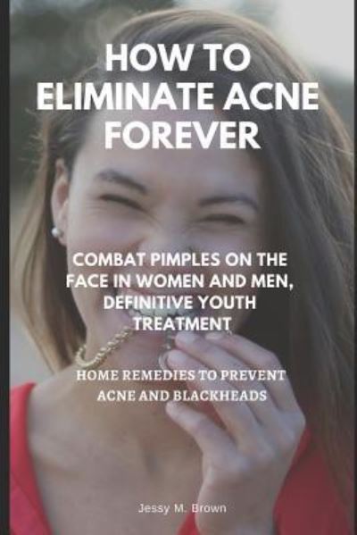 Cover for Jessy M Brown · How to Eliminate Acne Forever (Paperback Book) (2019)