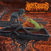 Cover for Nasty Surgeons · Infectious Stench (CD) (2018)