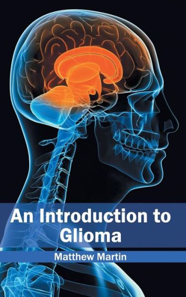 Cover for Martin, Matthew, Etc · An Introduction to Glioma (Gebundenes Buch) (2015)