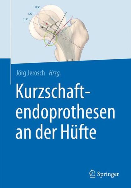 Cover for Kurzschaftendoprothesen an der Hufte (Hardcover Book) (2017)