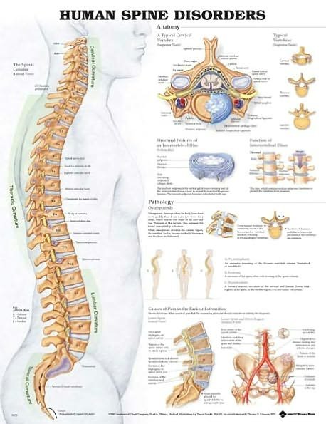 Cover for Acc 9970pl1.5 · Human Spine Disorders Anatomical Chart (Map) (2004)