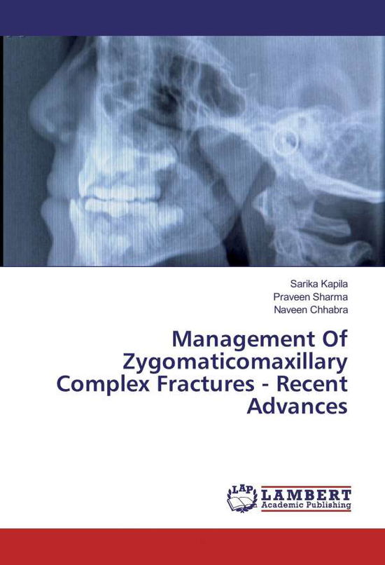 Cover for Kapila · Management Of Zygomaticomaxillar (Bok)