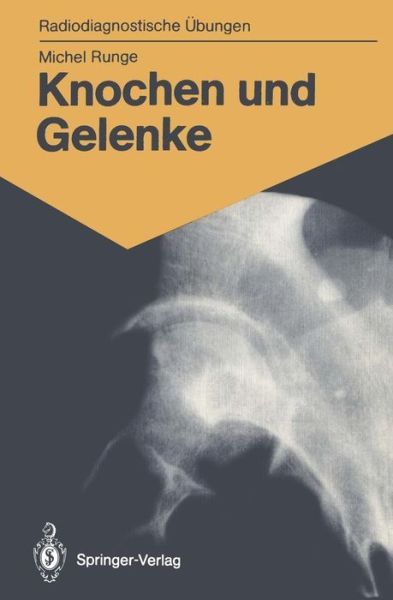 Cover for Michel Runge · Knochen und Gelenke - Radiodiagnostische Ubungen (Paperback Book) [German edition] (1987)