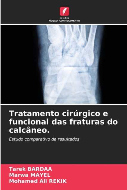 Cover for Tarek Bardaa · Tratamento cirurgico e funcional das fraturas do calcaneo. (Paperback Book) (2021)