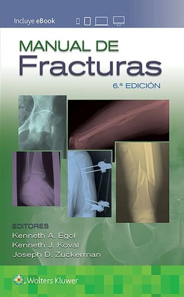 Manual de fracturas - Egol, Kenneth, MD - Böcker - Lippincott Williams & Wilkins - 9788417949440 - 10 juni 2020