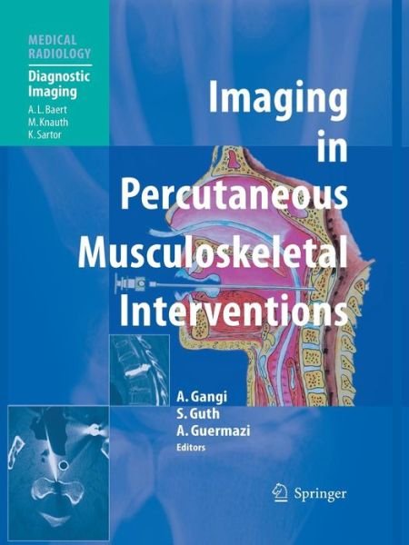 Cover for Afshin Gangi · Imaging in Percutaneous Musculoskeletal Interventions - Diagnostic Imaging (Pocketbok) [2009 edition] (2013)