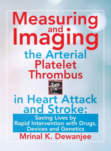 Cover for Mrinal K Dewanjee · Measuring and Imaging the Arterial Platelet Thrombus in Heart Attack and Stroke (Hardcover Book) (2021)