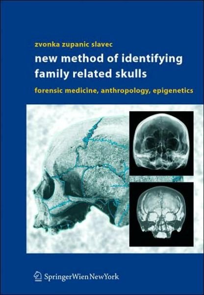 Cover for Zvonka Zupanic Slavec · New Method of Identifying Family Related Skulls: Forensic Medicine, Anthropology, Epigenetics (Gebundenes Buch) [2004 edition] (2004)