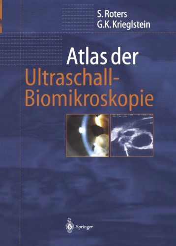 Cover for Sigrid Roters · Atlas der Ultraschall-Biomikroskopie (Paperback Book) [German, Softcover Reprint of the Original 1st Ed. 2001 edition] (2012)
