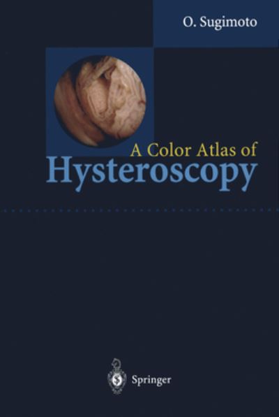 Cover for Osamu Sugimoto · A Color Atlas of Hysteroscopy (Hardcover Book) (1999)