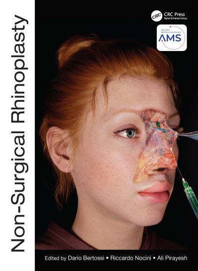 Non-Surgical Rhinoplasty - The PRIME Series (Hardcover Book) (2023)