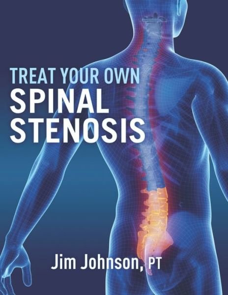 Treat Your Own Spinal Stenosis - Pt Jim Johnson - Boeken - Independently Published - 9798718988444 - 8 maart 2021