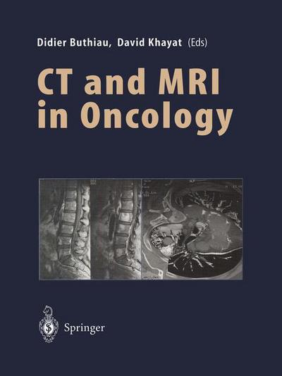 Cover for Didier Buthiau · CT and MRI in Oncology (Paperback Book) [Softcover reprint of the original 1st ed. 1998 edition] (2012)