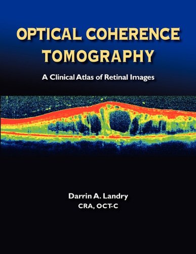 Cover for Darrin A. Landry · Optical Coherence Tomography a Clinical Atlas of Retinal Images (Paperback Book) (2011)