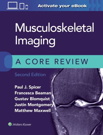 Musculoskeletal Imaging: A Core Review - A Core Review - Paul Spicer - Livros - Wolters Kluwer Health - 9781975120450 - 25 de novembro de 2020