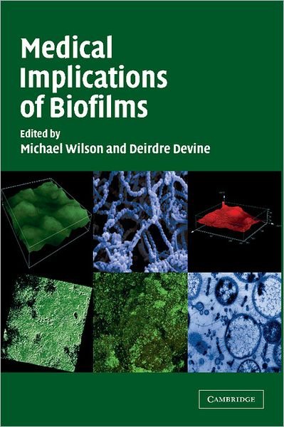Medical Implications of Biofilms - Michael Wilson - Livros - Cambridge University Press - 9781107403451 - 15 de setembro de 2011