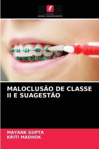 Cover for Mayank Gupta · Maloclusao de Classe II E Suagestao (Paperback Book) (2021)